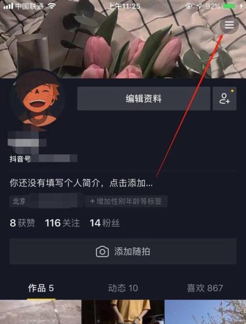 抖音如何接西瓜视频任务？操作流程和常见问题解答？